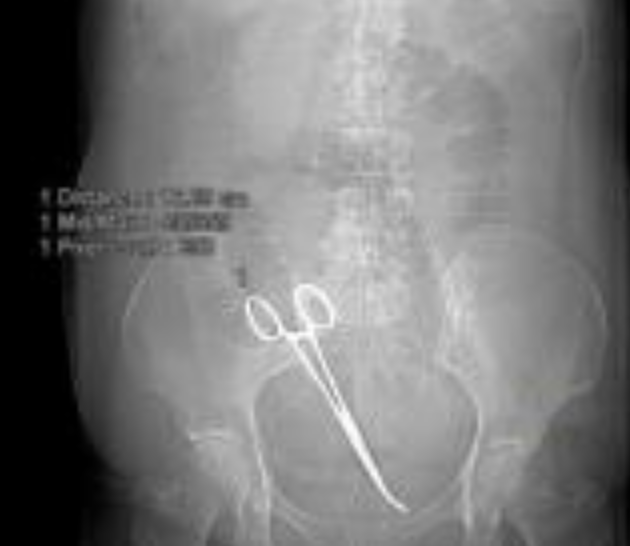 radiografia